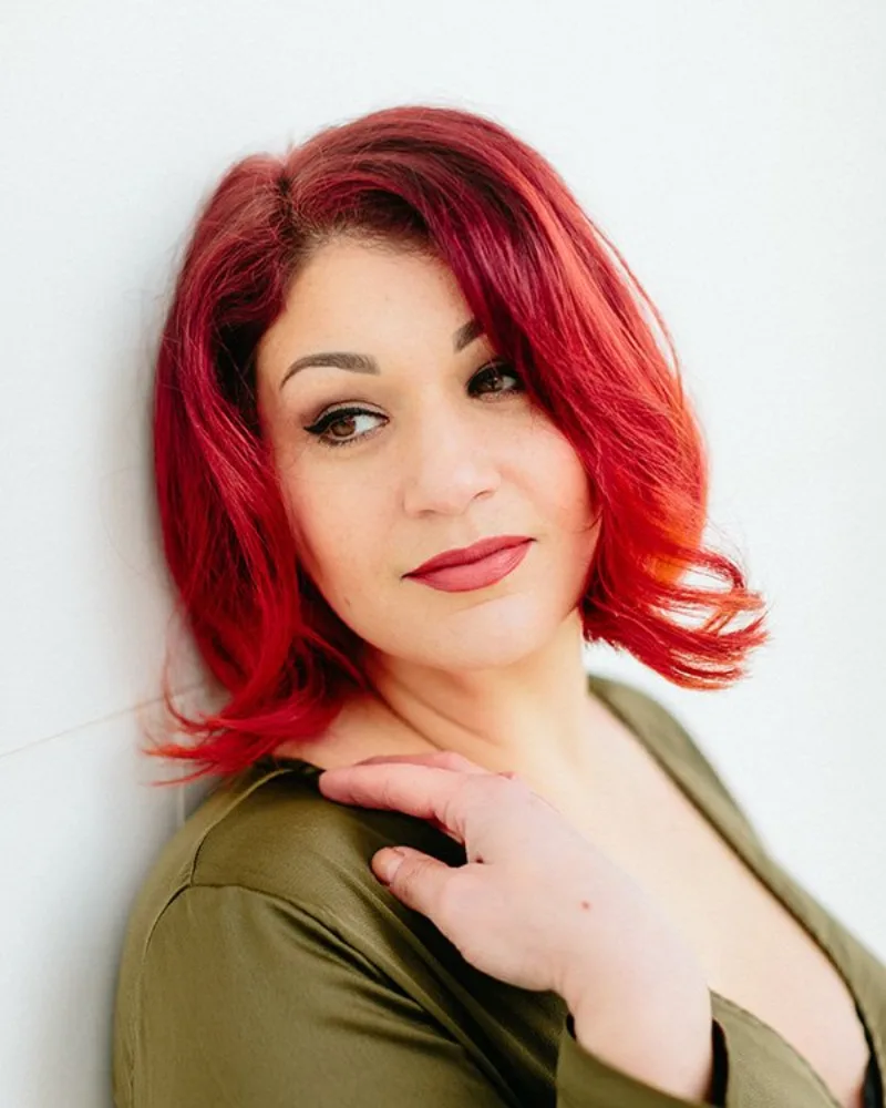 Botox Ergebnis 11 · Kuzbari Zentrum Wien